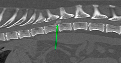 Neurochirurgie