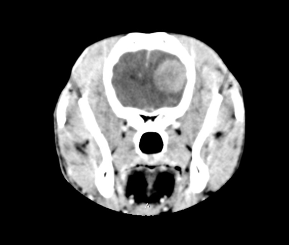 Neurologie